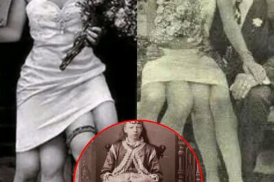 The Four-Legged Girl Who Shocked the World: The Secret Life and Hidden Strength of Josephine Myrtle Corbin